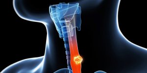 食道癌篩檢　內視鏡「窄頻光譜」一窺究竟！