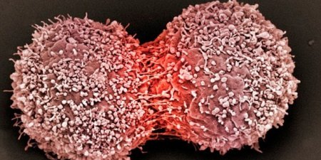 英研究：辨識「癌症要害」 打造客製化癌症療法