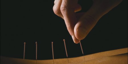 針灸美顏怕瘀青　針尖粗細是關鍵