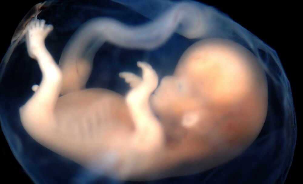 embrio-fetus