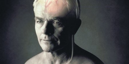巴金森氏病患者有福了！ 健保放寬「深層腦部刺激器」醫材給付規定