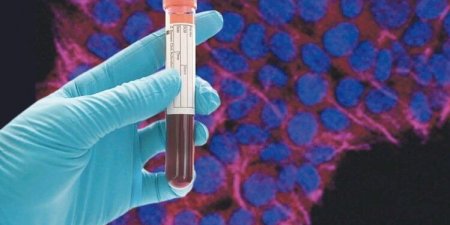 創源攜手泰宗生技 「液態切片」技術及早診斷肝癌腫瘤