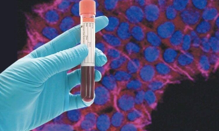 創源攜手泰宗生技 「液態切片」技術及早診斷肝癌腫瘤