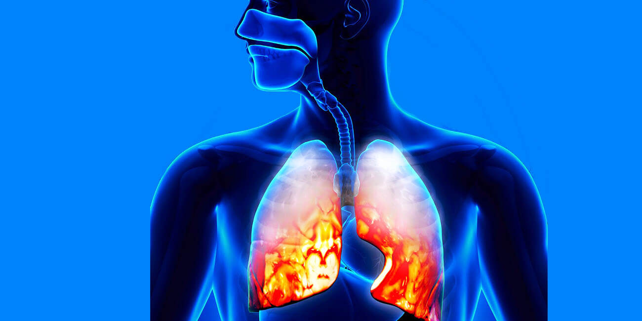 pneumonia