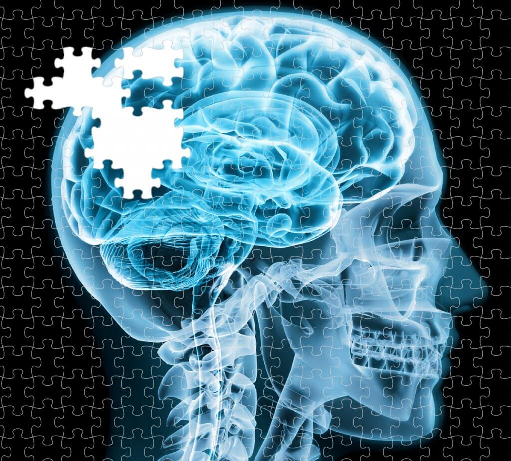 brain-puzzle