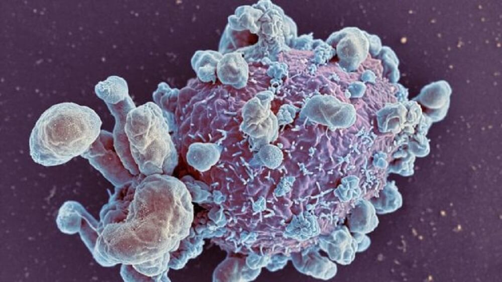 cancer-cell