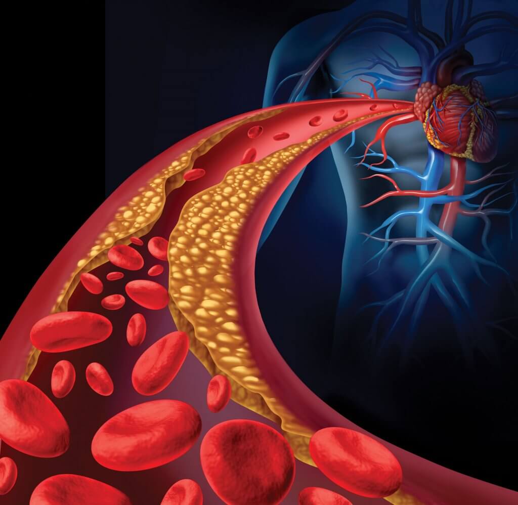 lower_cholesterol