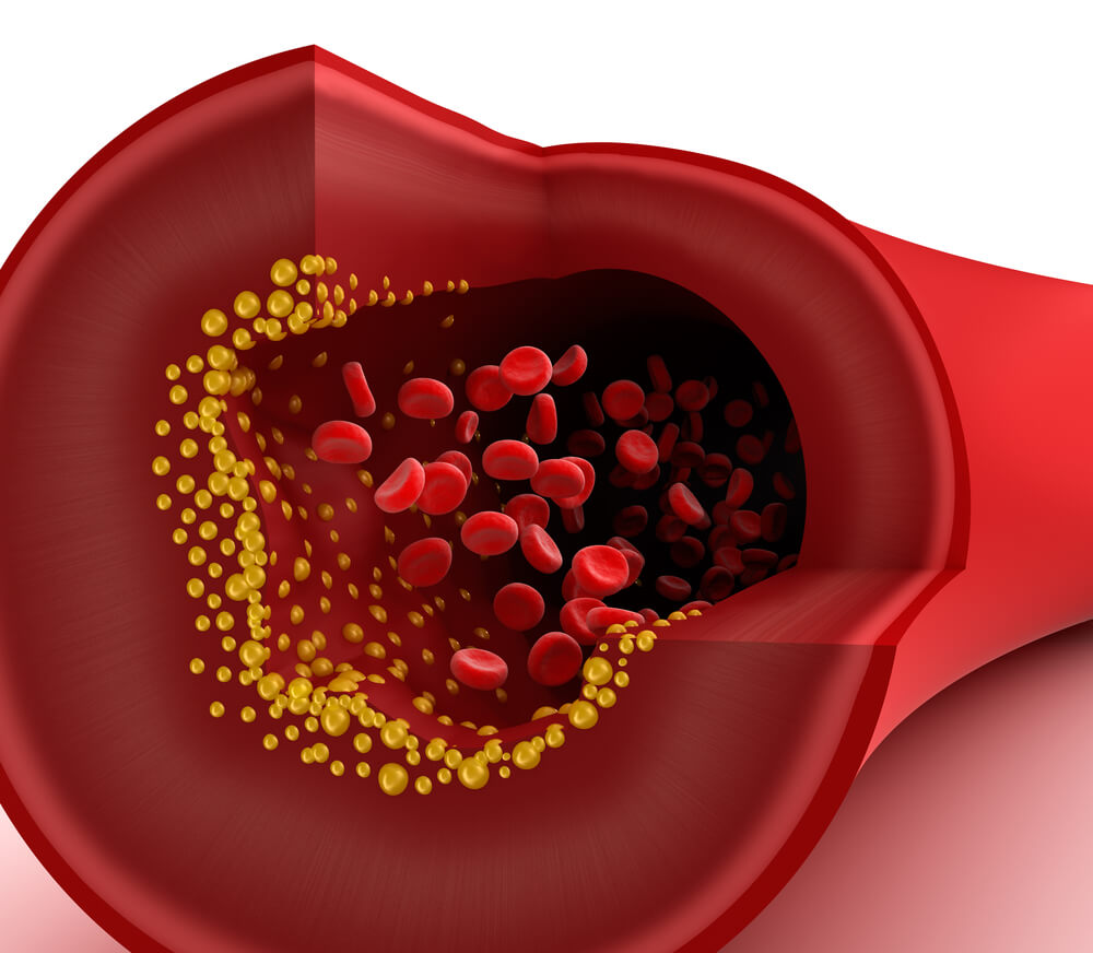 lower_cholesterol