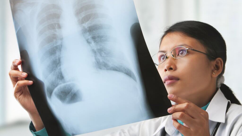 Female doctor checking xray image. focus on the xray image (with some grain or noise from it)
