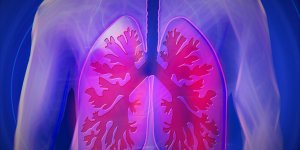 初期診斷是肺炎，但為何最後卻變成了肺癌？