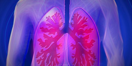 初期診斷是肺炎，但為何最後卻變成了肺癌？