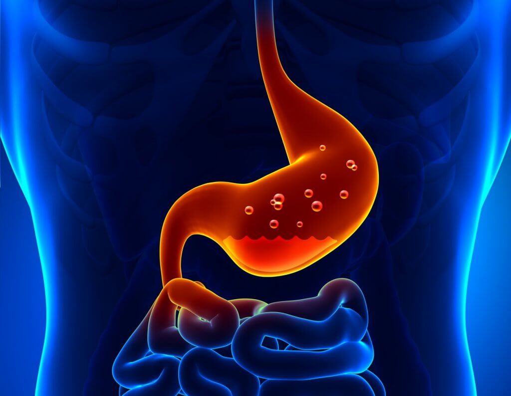 what-causes-acid-reflux
