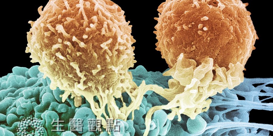 白血病新興療法 禁食可以餓死癌細胞？
