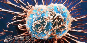 赴日就醫尋生機　免疫細胞治癌症