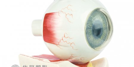 高度近視出現飛蚊症小心 恐視網膜剝離致失明