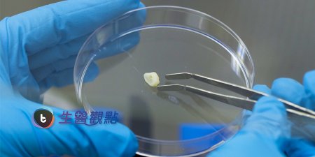 從乳牙長成大腦？ 美科學家培育乳牙幹細胞研究小兒自閉症