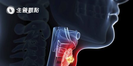9成頭頸癌放療後口乾 緩解要靠補「水」