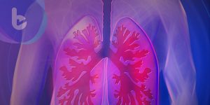 晚期肺癌不絕望　PD-L1檢測揭免疫療法生機