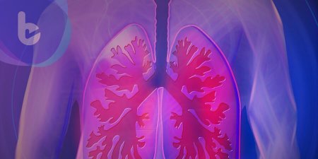 肺癌治療貴不一定有效   應全面性考量對症下藥