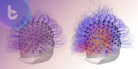 昏迷達15年之久的植物人  科學家成功以神經刺激喚醒意識