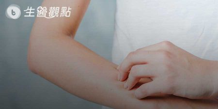 乾燥綜合症有什麼症狀？又該如何治療？