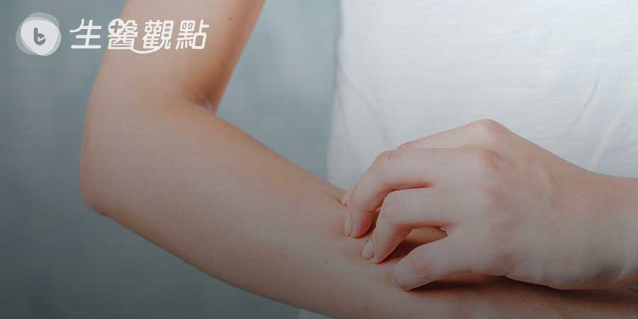 乾燥綜合症有什麼症狀？又該如何治療？