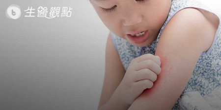 紅斑性狼瘡有什麼症狀？會遺傳嗎？