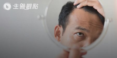 不到30歲就雄性禿　植髮機器人救回豐盛毛髮