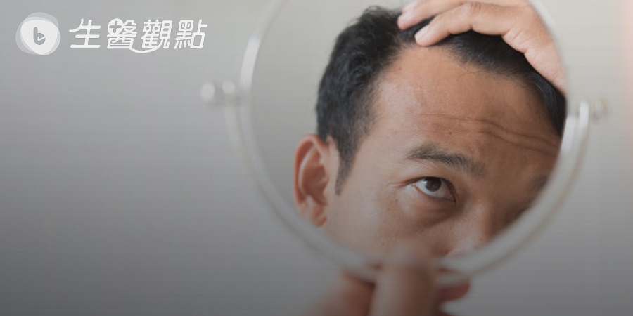 不到30歲就雄性禿　植髮機器人救回豐盛毛髮