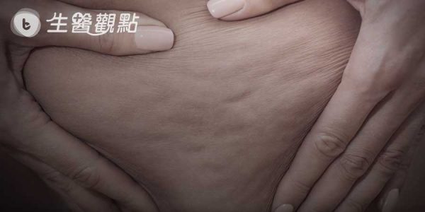 用擦的就能排毒溶脂，你真信嗎？揭開MAYSTAR王妃御用魔塑緊緻霜的驚人騙術