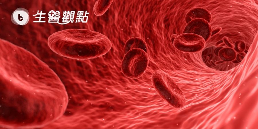 荷蘭研究：失智症與貧血相關