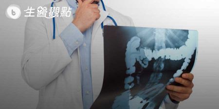 等到你發現時就晚了！　大腸癌治療前先這樣做
