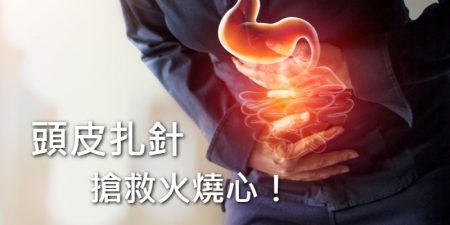 火燒心不見了！「一根針」治好胃食道逆流