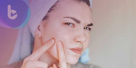 痘痘好不了？皮膚科醫師：這些抗痘NG行為別再犯了！