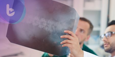 諾華推出全球首個脊髓性肌肉萎縮症(SMA)基因療法，治療2歲以下兒童！