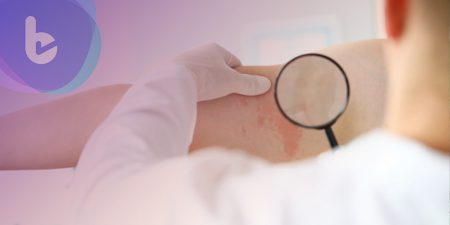 美科學家：抑制天花的牛痘病毒可用於製造COVID-19疫苗！