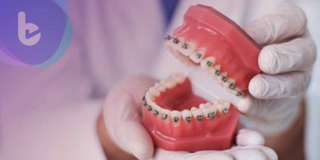 守護孩子健康「牙齒不能亂」！資深牙醫談兒少牙齒矯正黃金期