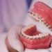 守護孩子健康「牙齒不能亂」！資深牙醫談兒少牙齒矯正黃金期