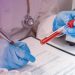 外科學家利用先進的技術揭示HIV的動態結構