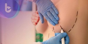 提升乳癌偵測率！3D乳房斷層精準偵測微小腫瘤