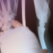 歐洲研究：骨穿孔的原因竟是糖分太少？