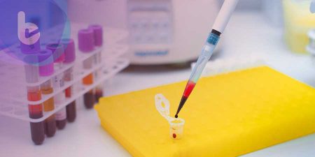 非侵入式產前親子鑑定   確認親緣簡單精準