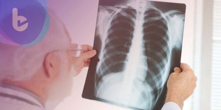 標靶藥物治療早期基因突變肺癌，降低復發率