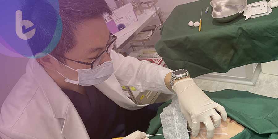 為何醫師要把蛇牙埋進臉部拉提?